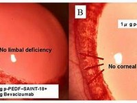 Bevacizumab1.JPG